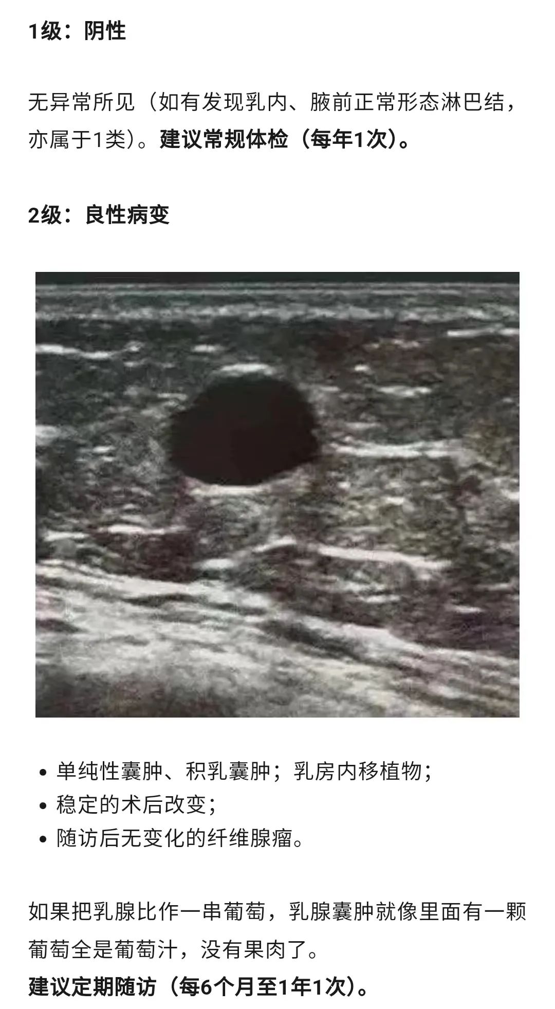 乳腺结节恶性的可能性有多大?一文读懂乳腺结节BI-RADS分级标准!