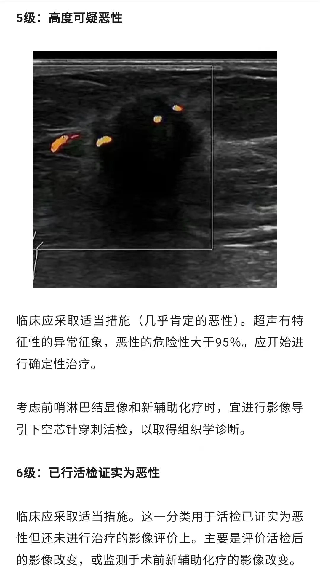 乳腺结节恶性的可能性有多大?一文读懂乳腺结节BI-RADS分级标准!